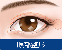 双眼皮修复
